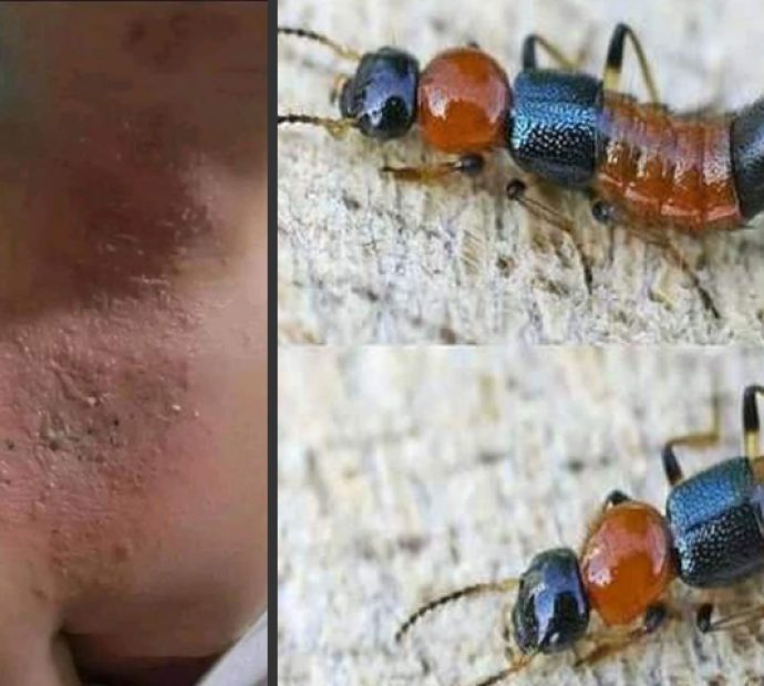 फ्लाई किराको आतंकमा पर्नुहोला !