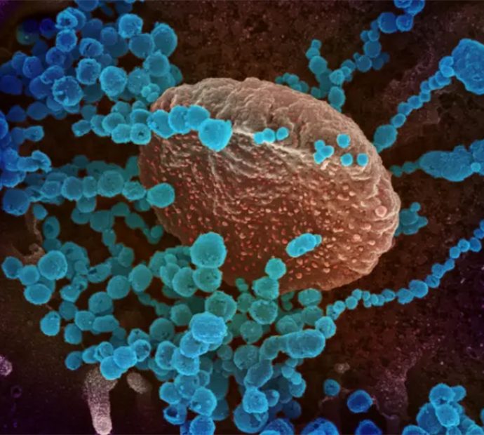 थप ११३ जनामा कोरोना संक्रमण, दूईजनामा ‘बीए.५’ पुष्टि