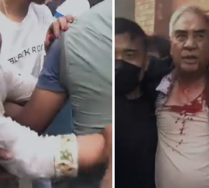 ७९ वर्षीय कांग्रेस सभापति देउवाको गर्धनमा चोट